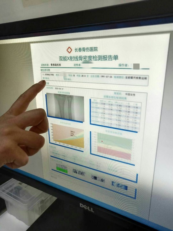 品源雙能X射線骨密度儀落戶吉林省長(zhǎng)春骨傷醫(yī)院，助力骨松診療
